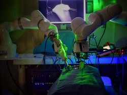 Canggih! Robot Ini Operasi Bedah Tanpa Bantuan Dokter