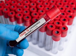 Jangan Panik! Ini Kata Menkes soal Kenaikan Kasus Covid-19 RI