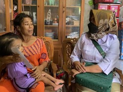 Andre Rosiade Kirim Bantuan untuk Penderita Hidrosefalus di Padang