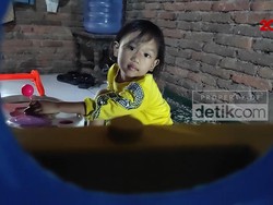 Perjuangan Bocah Sulsel Lawan Penyakit Langka Sejak Lahir