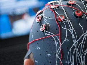 Apakah Perbedaan Otak Perempuan dan Pria?