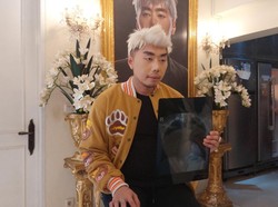 Roy Kiyoshi Alami Pembengkakan Jantung