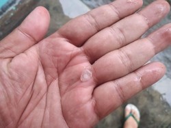 Pating Klothak! Hujan Es Sebiji Jagung Melanda Mlati Sleman Siang Ini