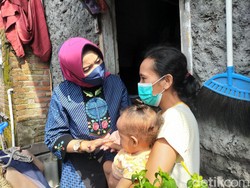 Balita Kelainan Kelamin Diatensi Pemkot Surabaya, Ayahnya Diberi Pekerjaan
