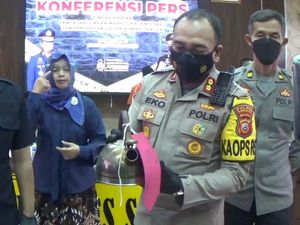 Sadis! Suami Siram Air Mendidih ke Muka Istri Gegara Cemburu