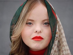 Penampilan Cantik Wanita Down Syndrome yang Dikontrak Jadi Model