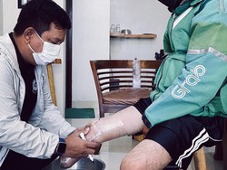 Viral! Kebaikan Hati Coki Bantu Ojol yang Diamputasi Dapatkan Kaki Lagi