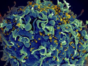 Varian Baru HIV yang Sangat Mematikan Ditemukan di Belanda