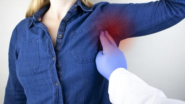 Breast Cancer Prevention Concept. A woman suffers from pain in the armpit. Sweating, unpleasant odor, redness, tooth and inflammation in the armpit.