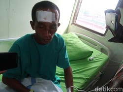 Cerita Ngeri Korban Selamat Bus Maut Bantul, Mobil Bermasalah Sejak Awal