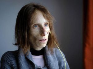 5 Kondisi Langka Buat Orang Tak Bisa Berhenti Makan sampai Makan Lewat Selang 5 Kondisi Langka Buat Orang Tak Bisa Berhenti Makan sampai Makan Lewat Selang