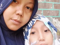 Perjuangan Penjual Celengan dan Anak Penderita Wolf Hirschhorn, Yuk Bantu!