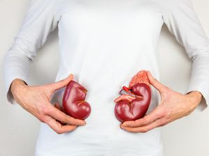 Apakah Penyakit Ginjal Bisa Sembuh? Dokter Beberkan Jawabannya Apakah Penyakit Ginjal Bisa Sembuh? Dokter Beberkan Jawabannya