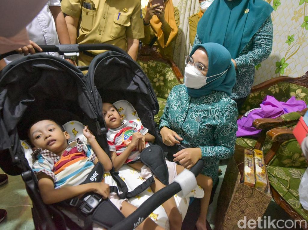 Pemkot Surabaya Bantu Anak Kembar yang Alami Kelumpuhan Otak