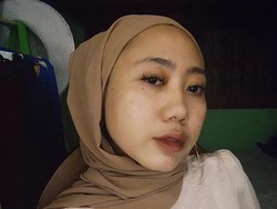 Eks Vokalis Amigdala Aya Canina Serukan Dukungan untuk Quweenjojo