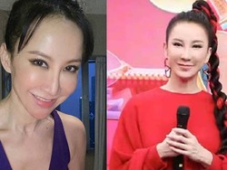 Dituding Operasi Plastik, Aktris Ini Malah Dihujat Penampilannya