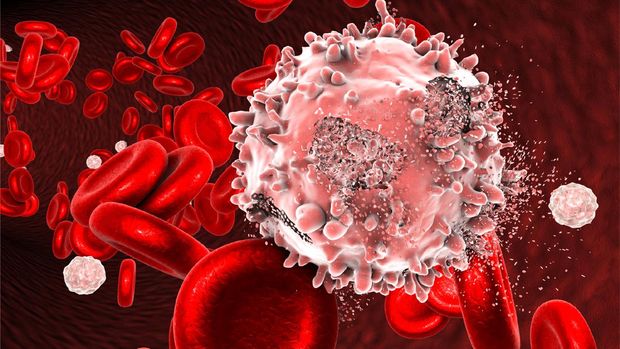 Ilustrasi leukemia