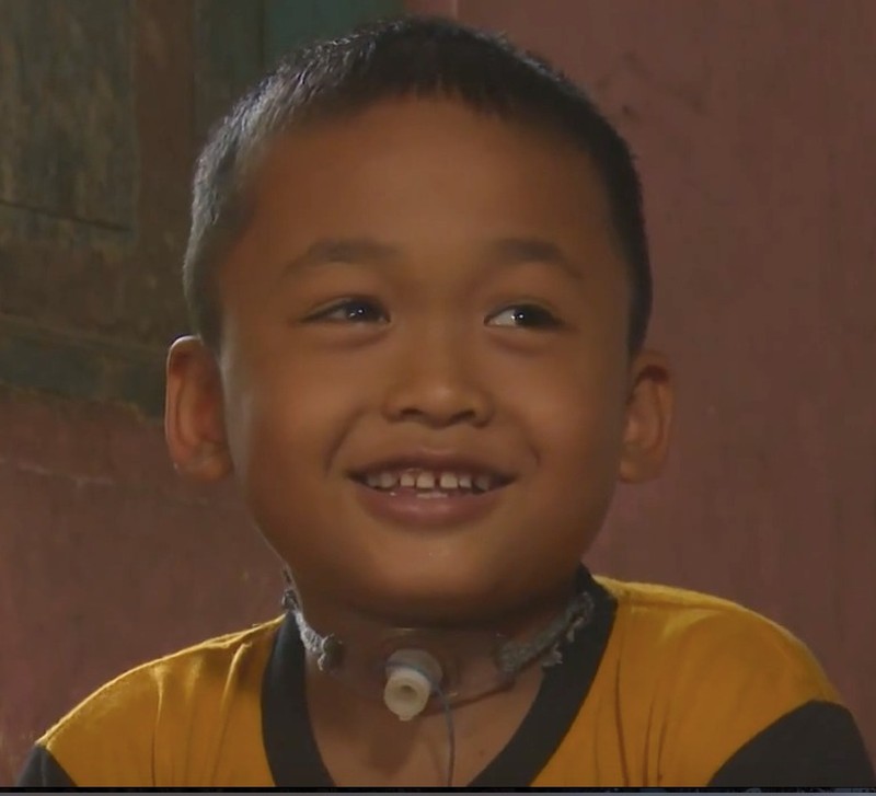 Cerita Sedih Rafli Tak Lagi Sekolah Usai Leher Bolong Gegara Ditendang Sapi