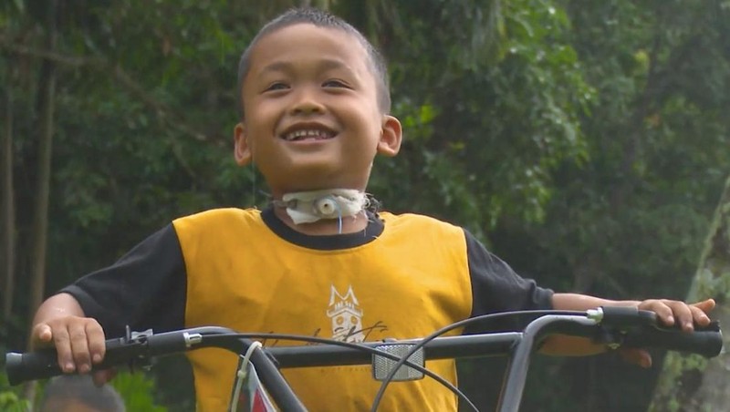 Rafli Butuh Uluran Tangan, Lehernya Bolong hingga ISPA Gegara Ditendang Sapi