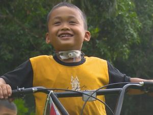 Rafli Butuh Uluran Tangan, Lehernya Bolong hingga ISPA Gegara Ditendang Sapi