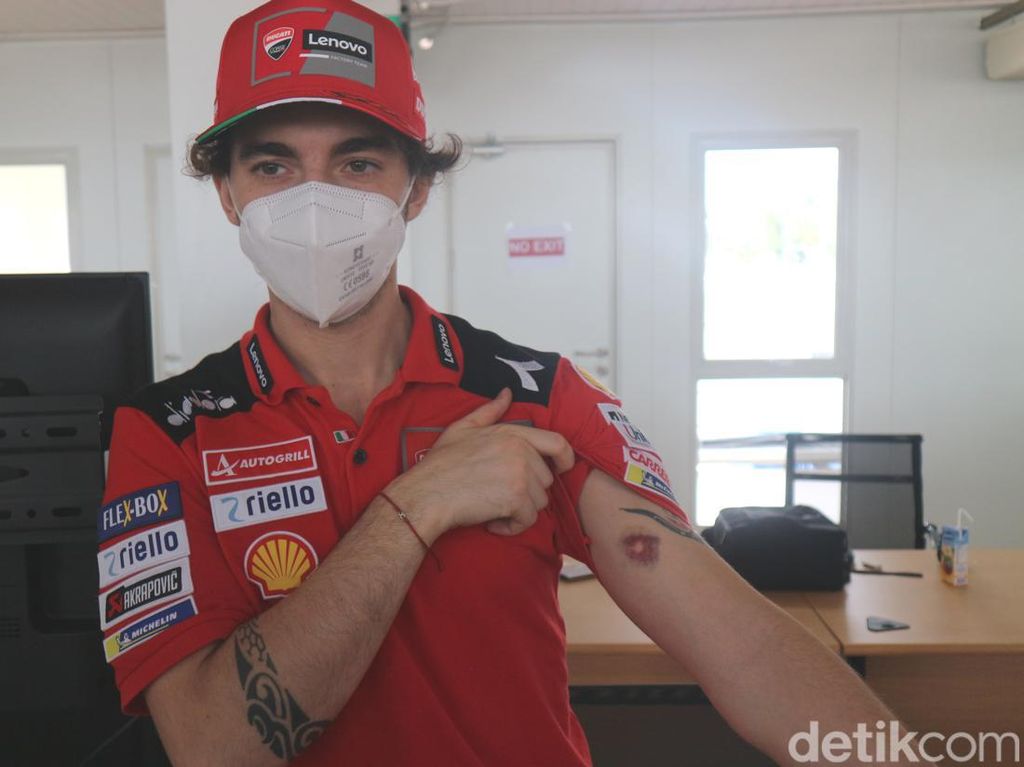Rider MotoGP Memar Usai Jajal Sirkuit Mandalika, Netizen: Pakai Minyak Tawon Rider MotoGP Memar Usai Jajal Sirkuit Mandalika, Netizen: Pakai Minyak Tawon