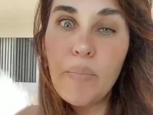 Penampilan Aneh Wanita Gagal Botox, Matanya Jadi Kecil Sebelah