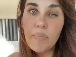 Penampilan Aneh Wanita Gagal Botox, Matanya Jadi Kecil Sebelah