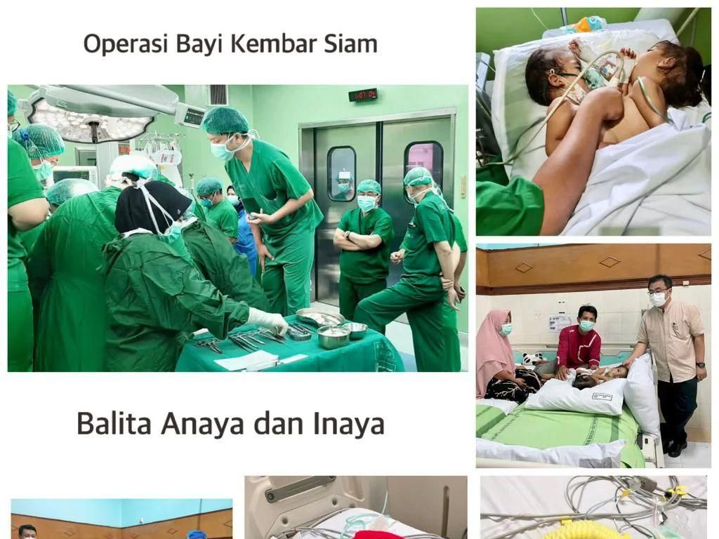RSU Soetomo Berhasil Operasi Balita Kembar Siam Dempet asal NTB