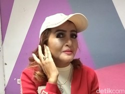 Machica Mochtar Lapor Polisi Usai Jadi Korban Tabrak Lari?