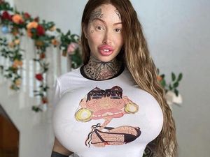 Selebgram Keranjingan Oplas, Organ Intim hingga Hidung Barbie Selebgram Keranjingan Oplas, Organ Intim hingga Hidung Barbie