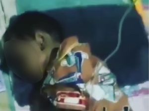 Viral Anak Yatim di Bekasi Diduga Gizi Buruk, Ternyata Penyintas HIV/AIDS