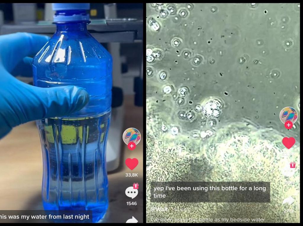 Air Minum di Botol yang Jarang Diganti Terbukti Kotor, Ini Hasil Uji Mikroskopnya
