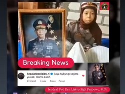 Kapolri Bawa Bocah Sinta Penderita Tumor Tulang ke RS Polri, Janji Jenguk