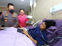 Jenguk Bocah Rembang Penderita Tumor, Kapolri Beri Pesan Menyentuh