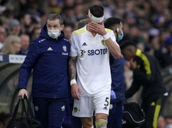 Protes PFA soal Cedera Kepala di Laga Leeds United Vs MU