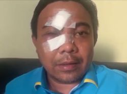 Haris Pertama Sebut Ada Sosok di Balik Azis Samual