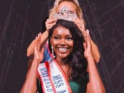 Kematian Tragis Ratu Kecantikan, Koma Seminggu Setelah Lompat dari Lantai 3