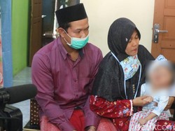 Pilu Alwi Balita Derita Hidrosefalus Asal Kudus