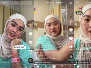Kulit Wanita Bekasi Melepuh Usai Terpapar COVID-19, Ternyata Ini Sebabnya Kulit Wanita Bekasi Melepuh Usai Terpapar COVID-19, Ternyata Ini Sebabnya