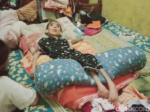Sedih, Bocah Piatu Asal Klaten Ini Lumpuh Gegara Infeksi Selaput Otak