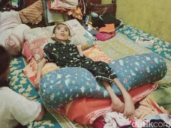 Sedih, Bocah Piatu Asal Klaten Ini Lumpuh Gegara Infeksi Selaput Otak