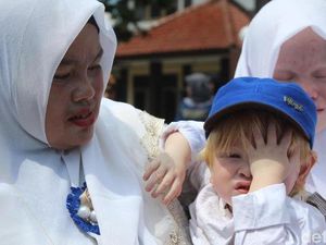 Aneh dan Unik, Kisah Kampung Albino di Ciburuy Garut