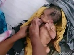 Bayi Cantik Masih Hidup Ditemukan Dibuang di Selokan Bondowoso