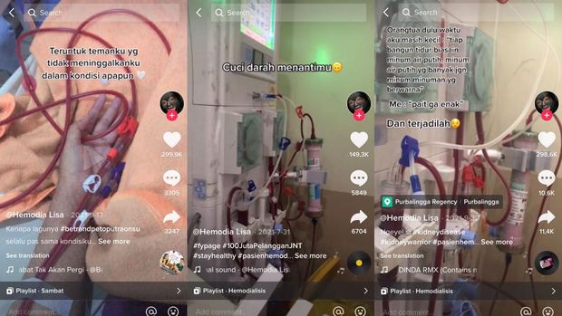 Viral pasien gagal ginjal