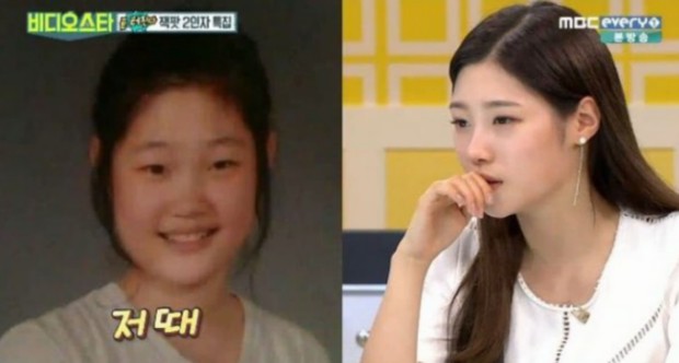 Chae Yeon sebelum dan sesudah diet