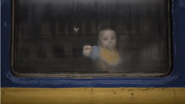 Pilu! Wajah-wajah Tak Berdosa Korban Perang Rusia-Ukraina