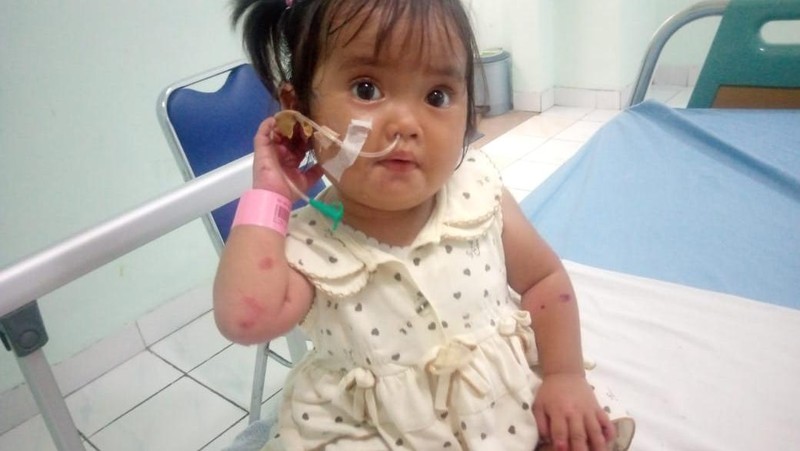 Kabar Terbaru Adik Eliza Penderita Kulit Melepuh, Kamu Masih Bisa Bantu!