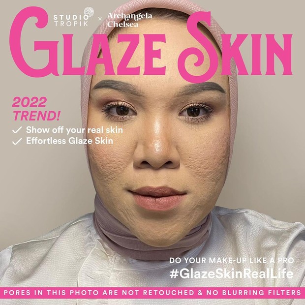 Salah Satu Campaign Cut Rizki Untuk Mencintai Tekstur Kulit/Foto : instagram.com/@crvhons Salah Satu Campaign Cut Rizki Untuk Mencintai Tekstur Kulit/Foto : instagram.com/@crvhons