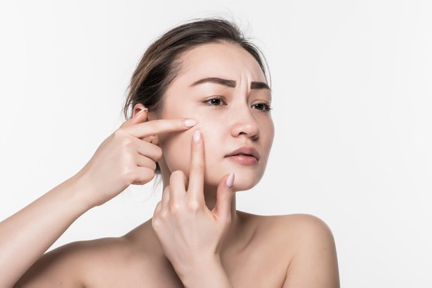 Manfaat propolis untuk kulit wajah