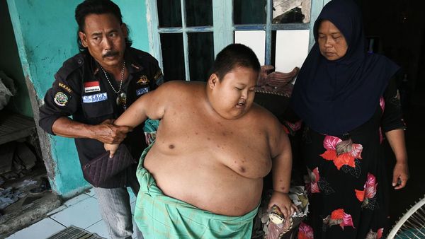 Bocah Asal Bekasi Ini Berbobot 115 Kilogram